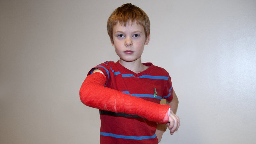 Ett barn med rött gips