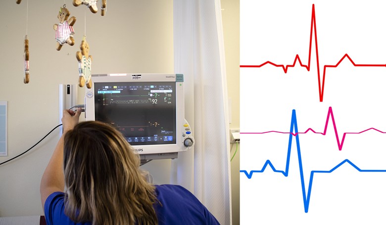 EKG-kurva på en skärm