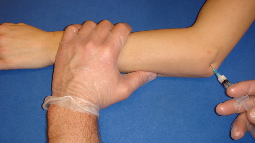 Leden mellan radius och humerus når man lättast genom att införa nålen i medial riktning omedelbart distalt om humerus laterala epikondyl och proximalt om radius.