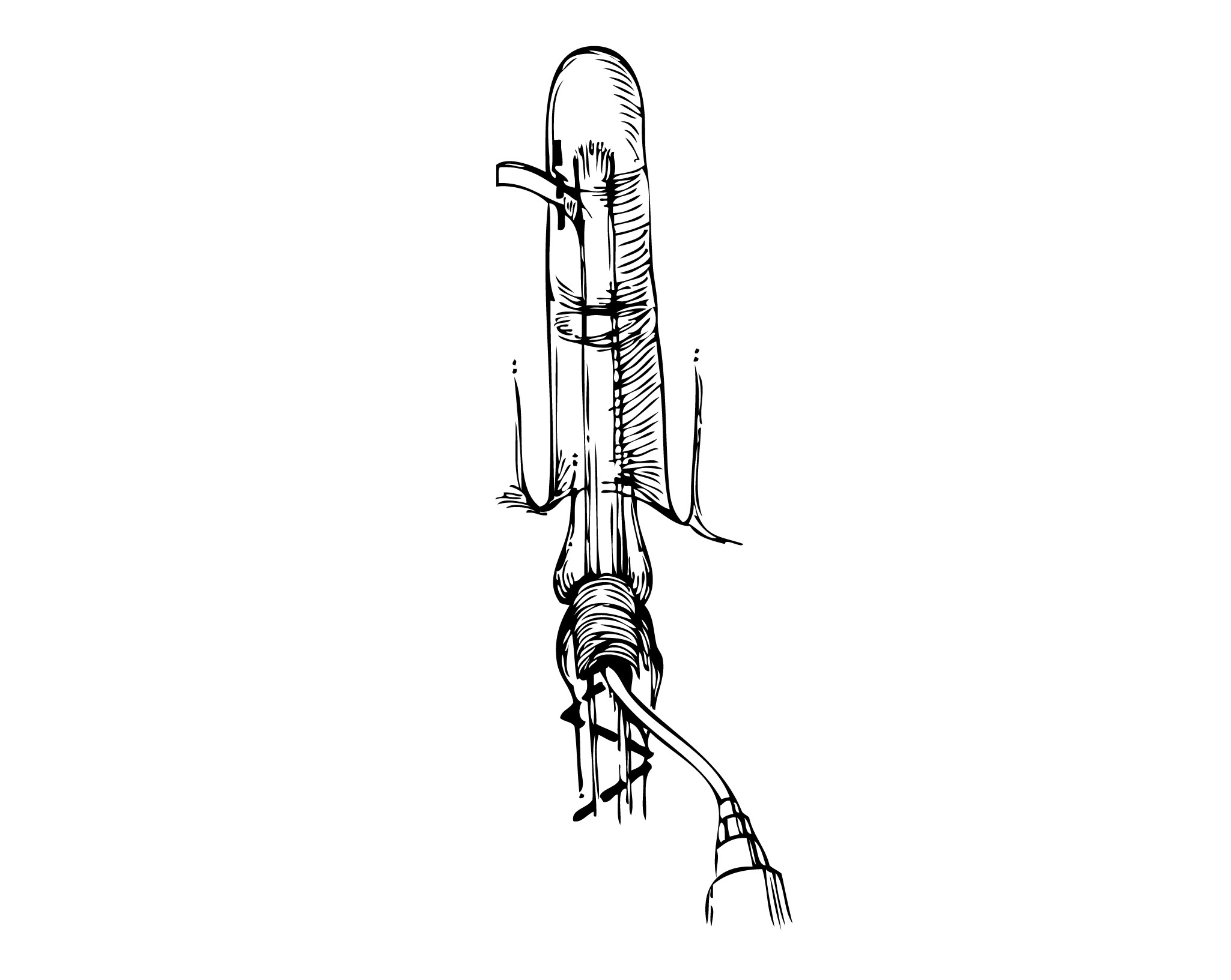 Svart och vit illustration över genomspolning av senskidan