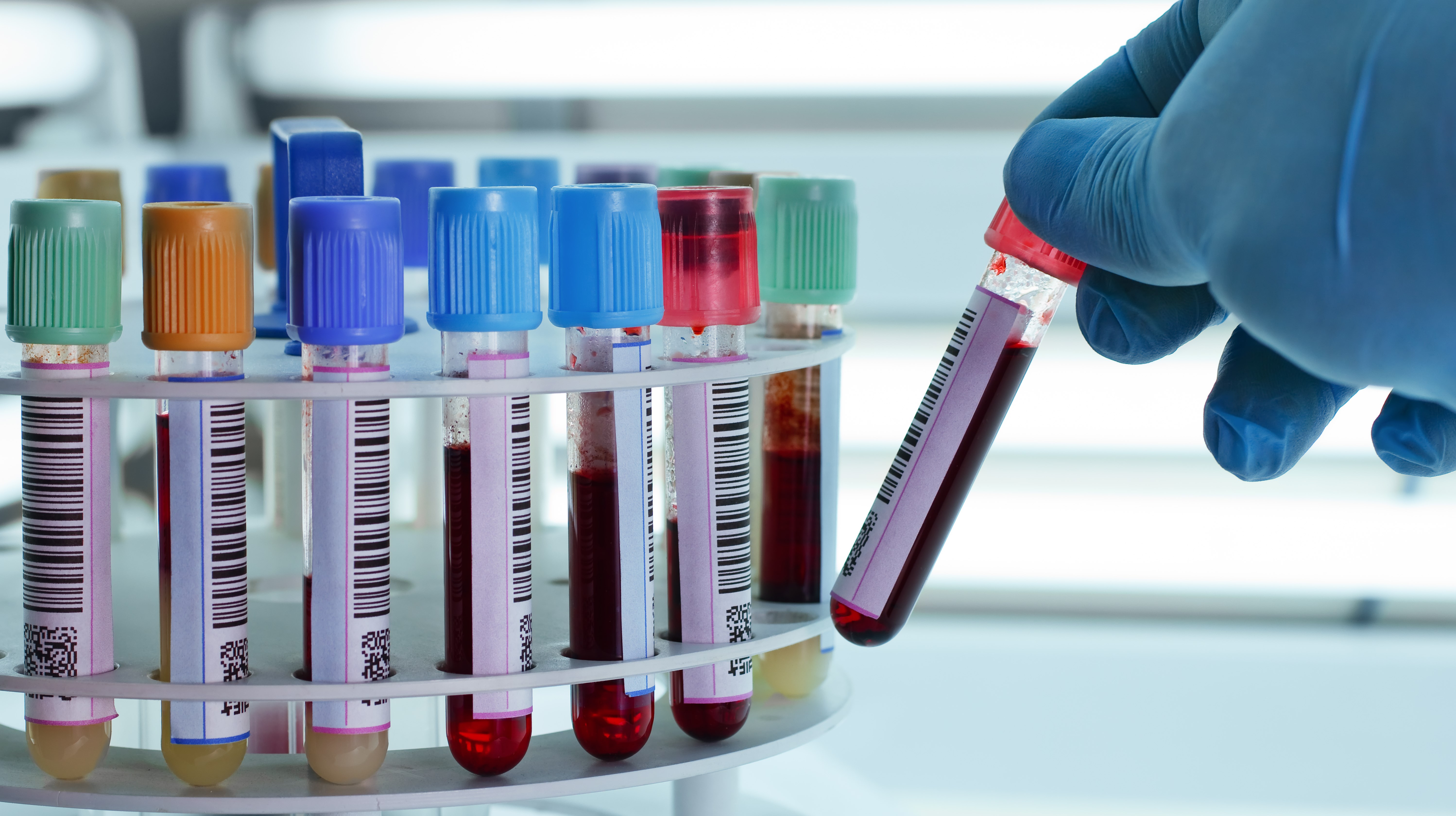 technician placing blood tubes in the laboratory centrifuge