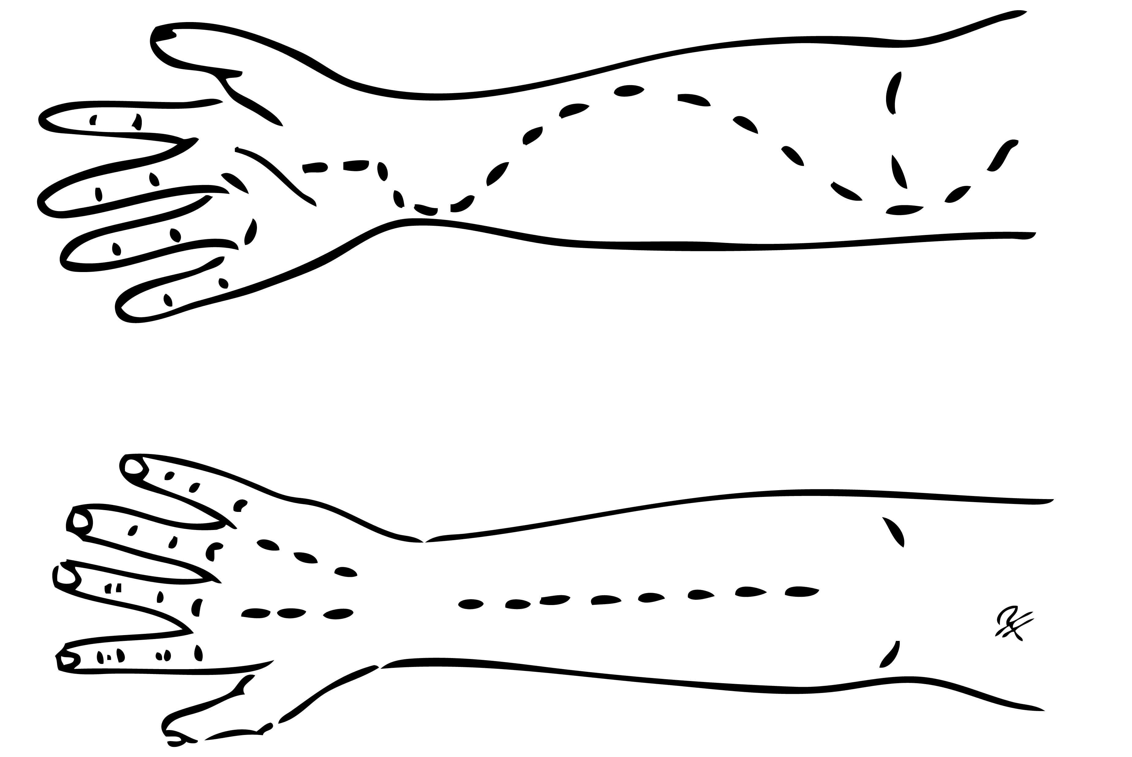 Svart och vitt diagram av kirurgisk fasciotomi