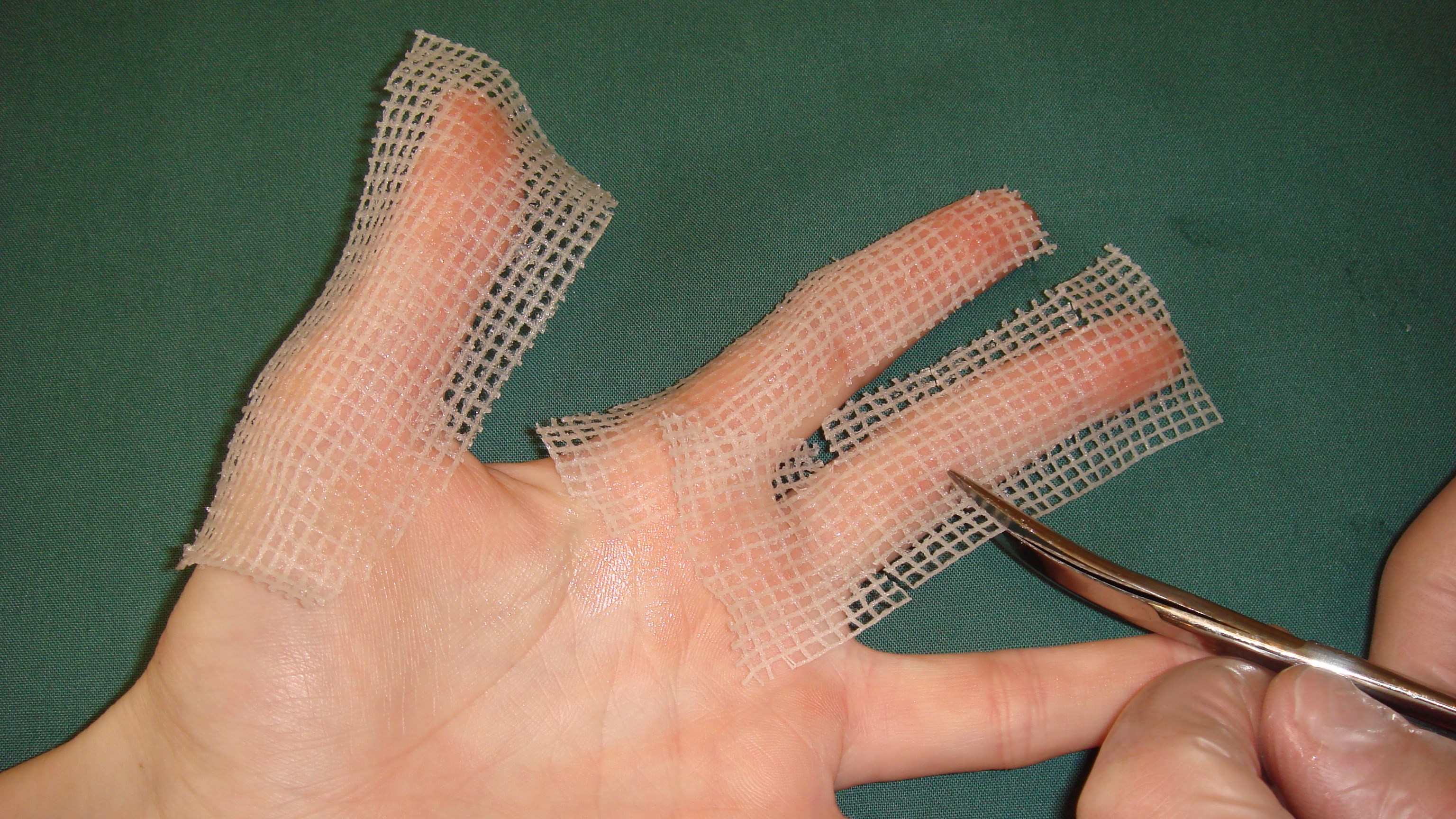 Torrt förband – börja närmast huden med ett lager salvkompress för att undvika att förbandet fastnar i såren.