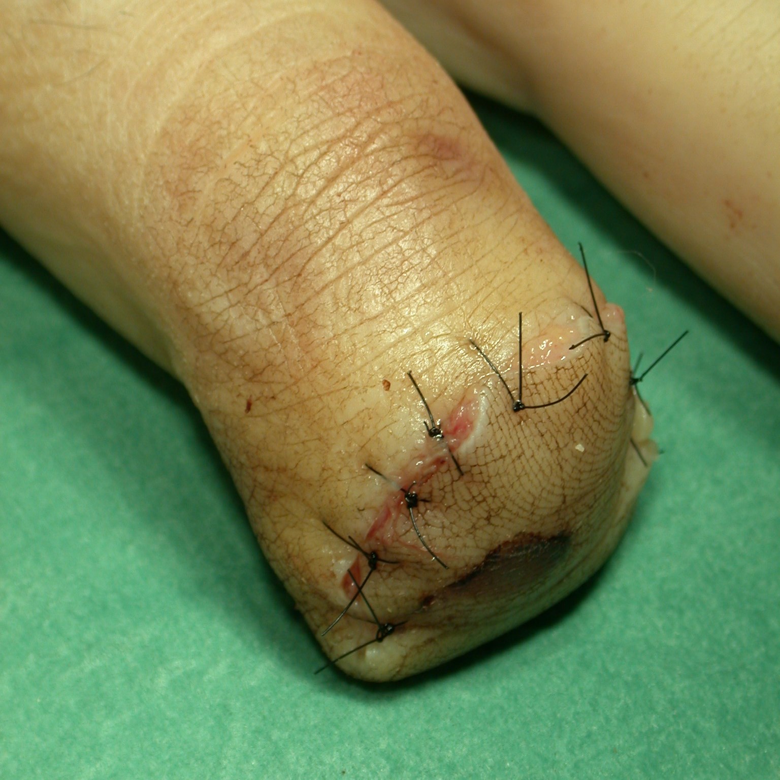 Kontrollera att täckning kan uppnås