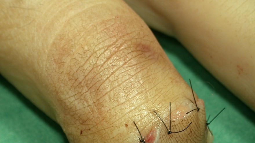 Kontrollera att täckning kan uppnås