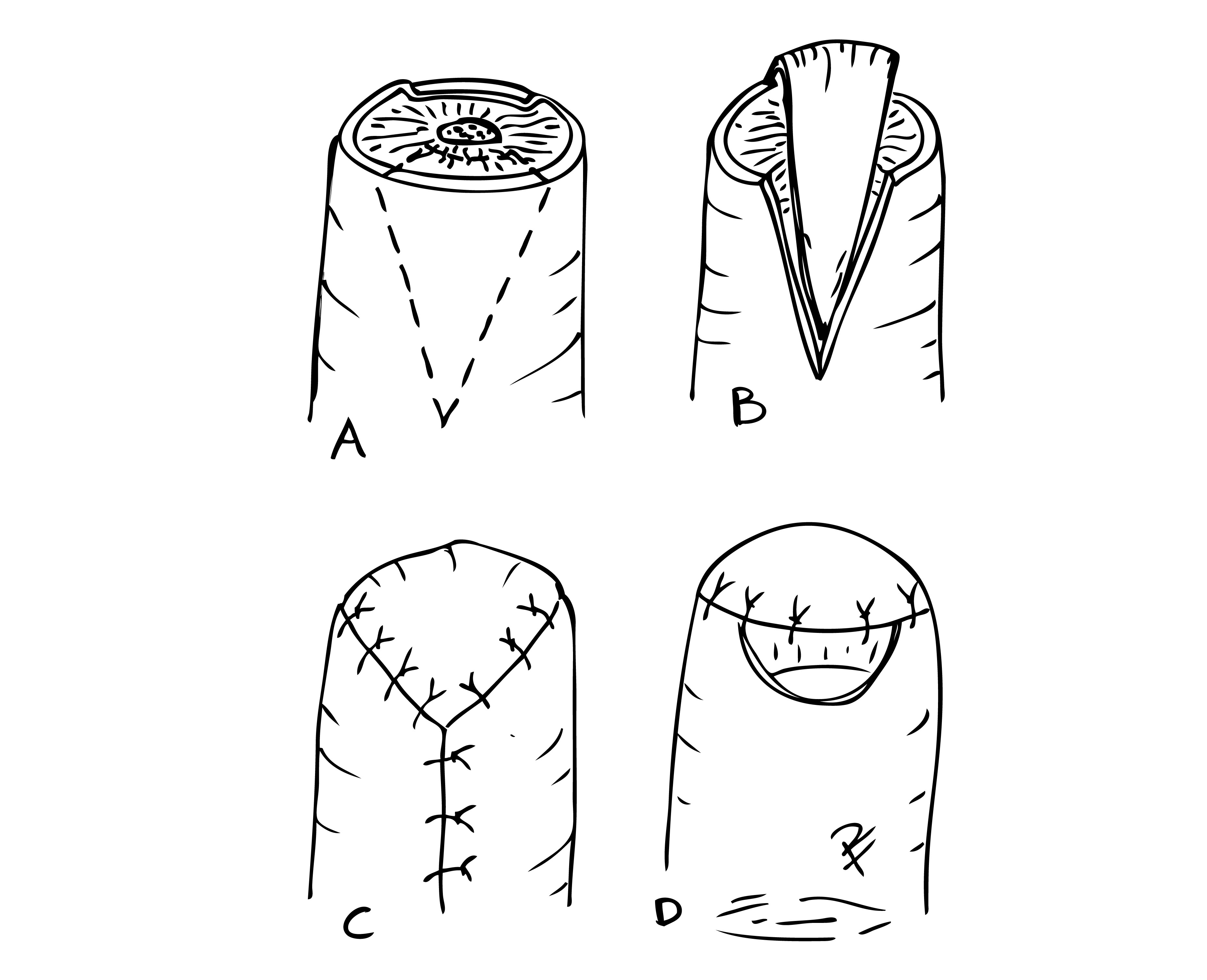 Illustration i svart och vit över V till Y plastik, tecknat av Per Fredrikson