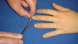 Steril handske förs på patientens hand. Ett mycket litet hål klipps i toppen på det finger som man önskar erhålla blodtomt fält på.
