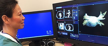 Röntgensjuksköterska Mina Chao framför bildskärm med röntgenbild