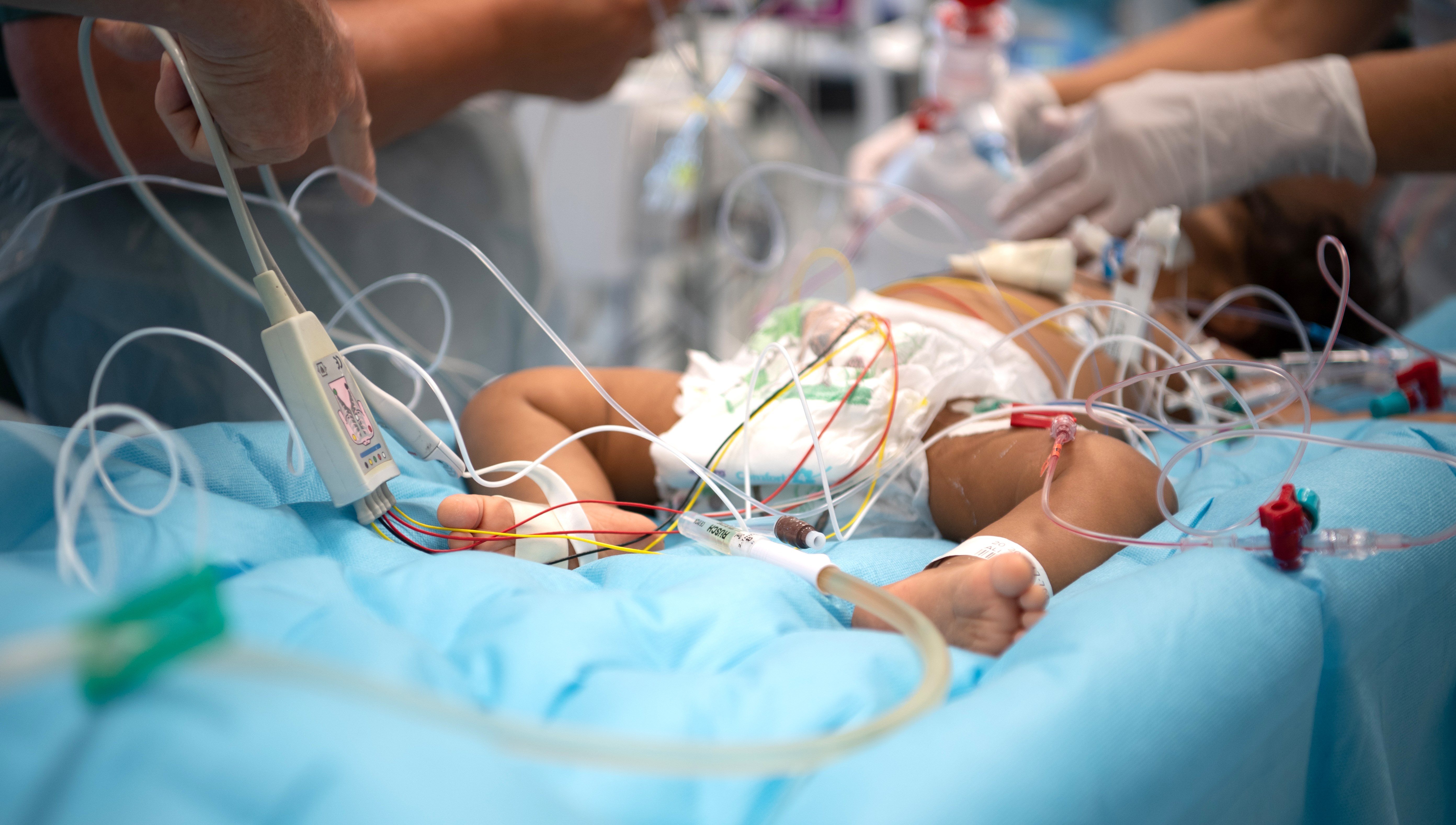 bebis på operationsbord