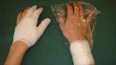 Slutresultatet. Till höger jämförande bild mellan initial behandling med påse och torrt förband.