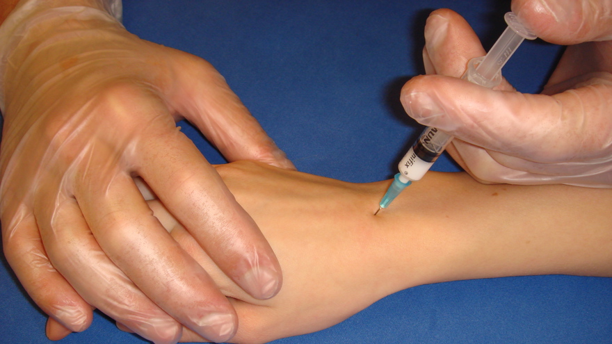 Handleden penetreras bäst från dorsal sidan då den är relativt fri från nerver och artärer.