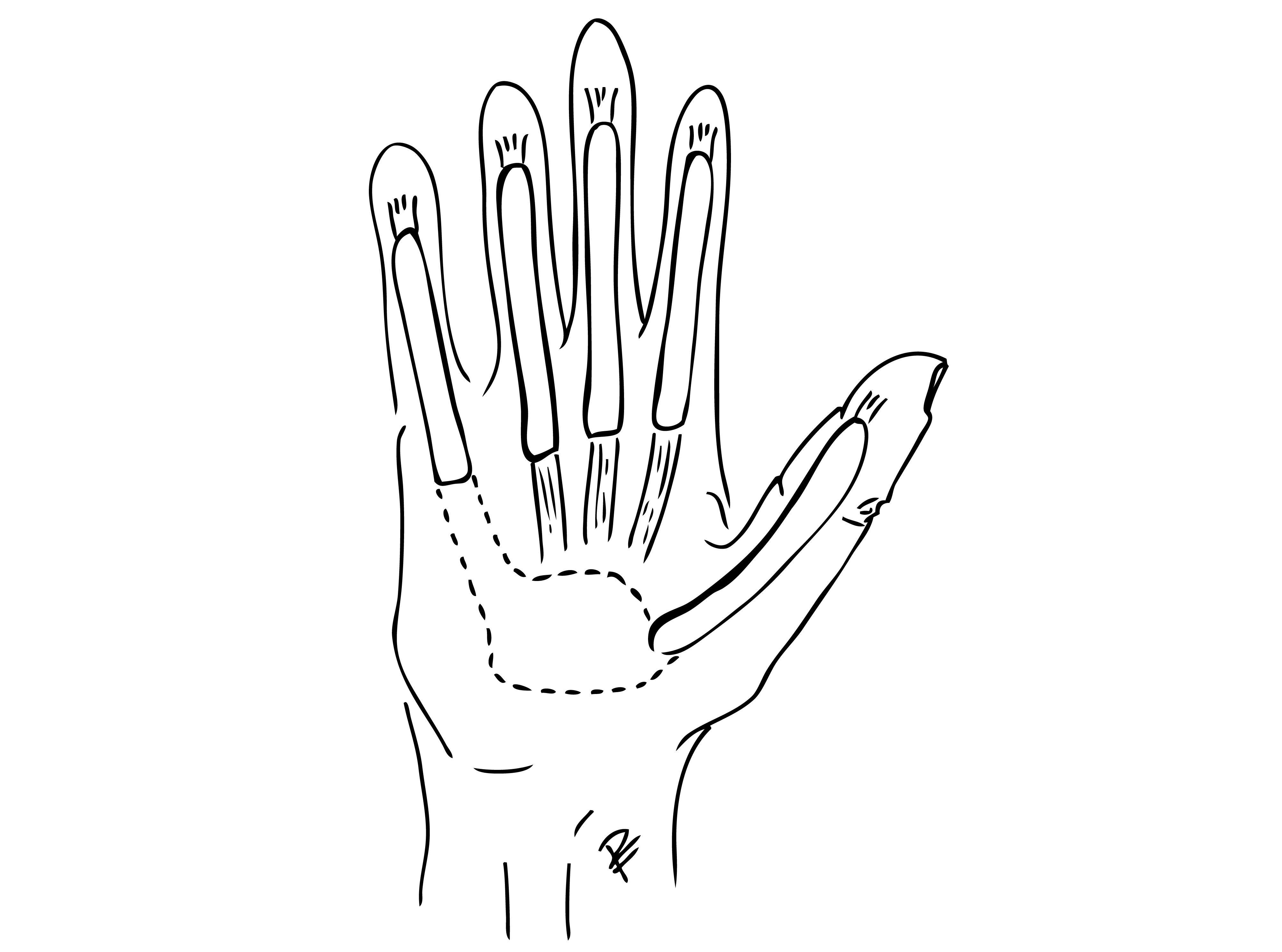 Svart och vit schematisk bild över senskidornas anatomi. Streckad linje visar eventuell förbindelse mellan tumme och lillfinger.
